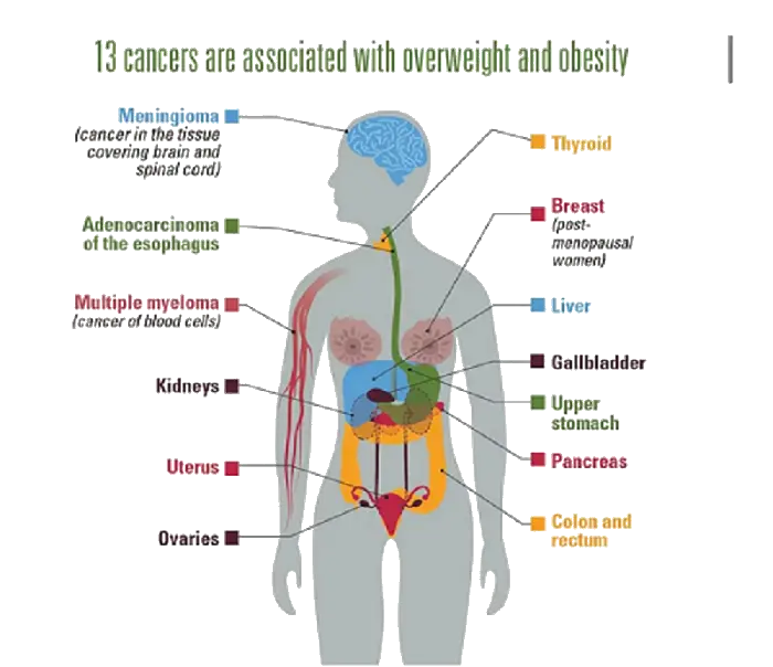 13-cancers-associated-with-overweight-and-obesity